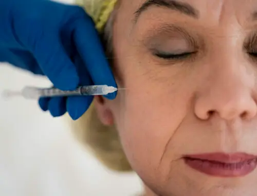 The Best Dermal Fillers For Over 50s